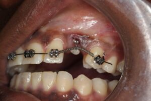 Dr. Rushik Dhaduk orthodontics