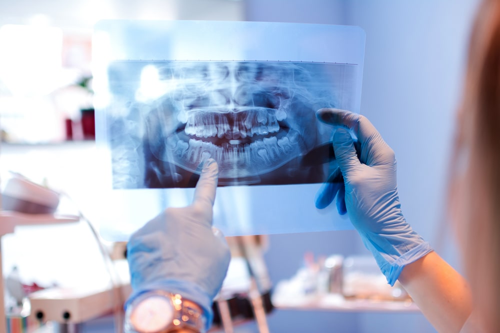 Oral surgery in Canada