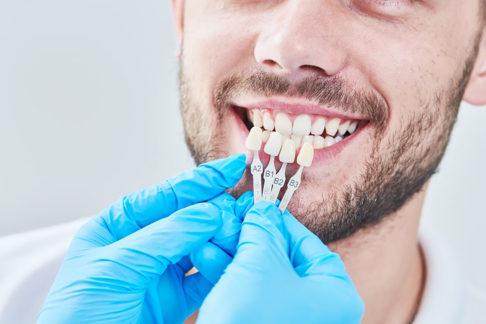 Prosthodontics in Toronto